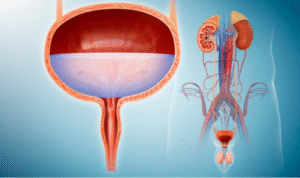 Best Urologist In Bangalore