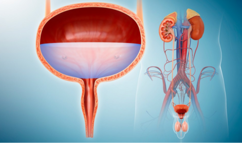 Best Urologist In Bangalore